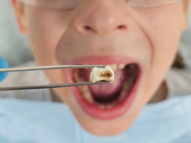 Best Emergency Broken Tooth Repair in Como, WI